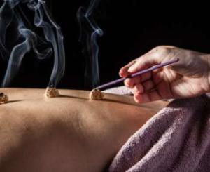 Burnaby Moxibustion treatment