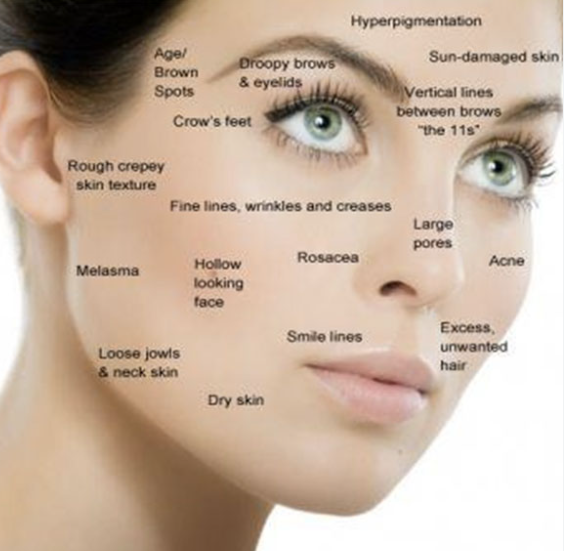 Facial Acupuncture or Cosmetic Acupuncture