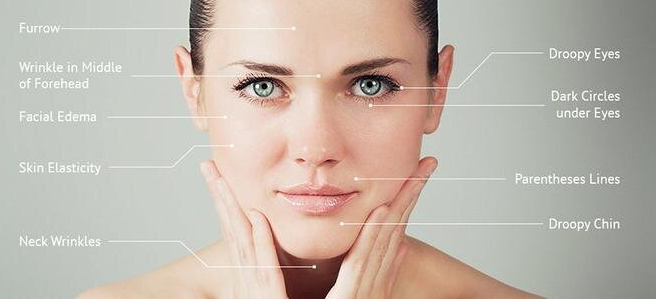 Buccal rejuvenation acupuncture facial 