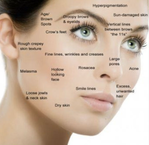 Burnaby Acupuncture